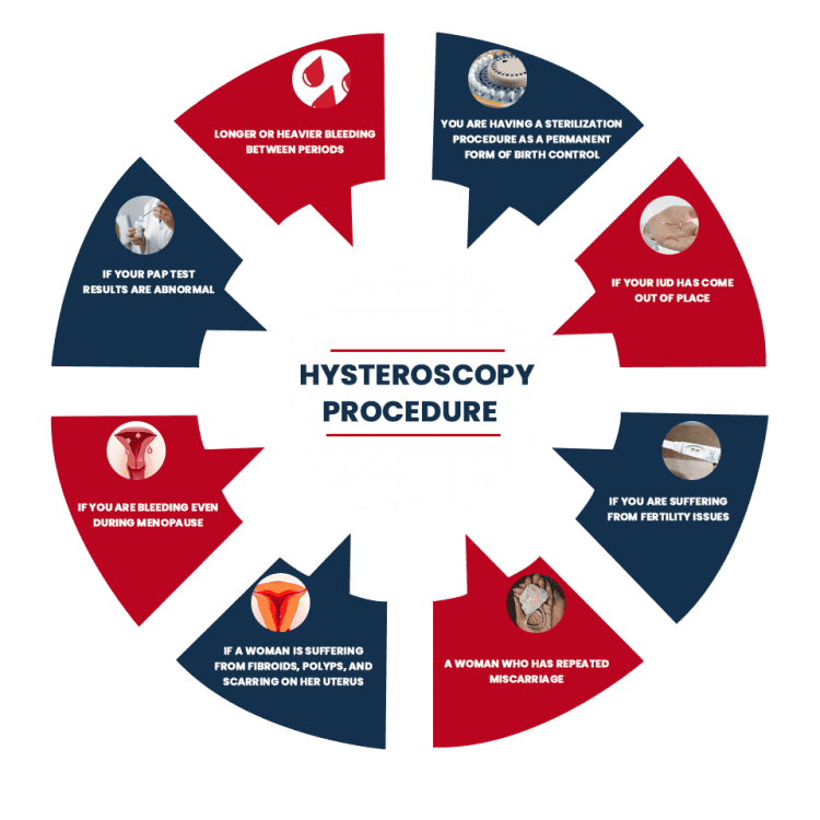 Hysteroscopy procedure